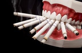 È possibile fumare dopo un'estrazione dei denti